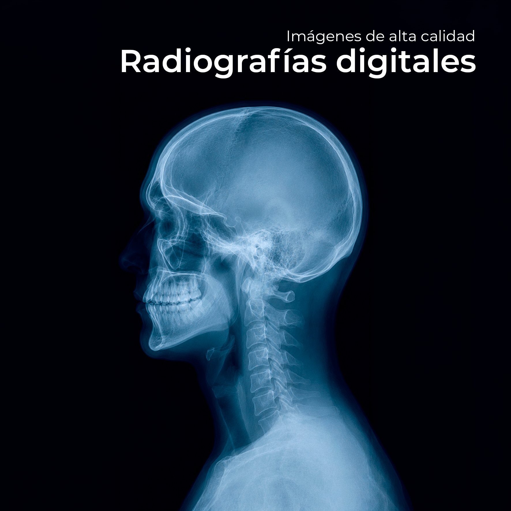 Unidad móvil de RayosX San Luis para servicio de radiología a domicilio